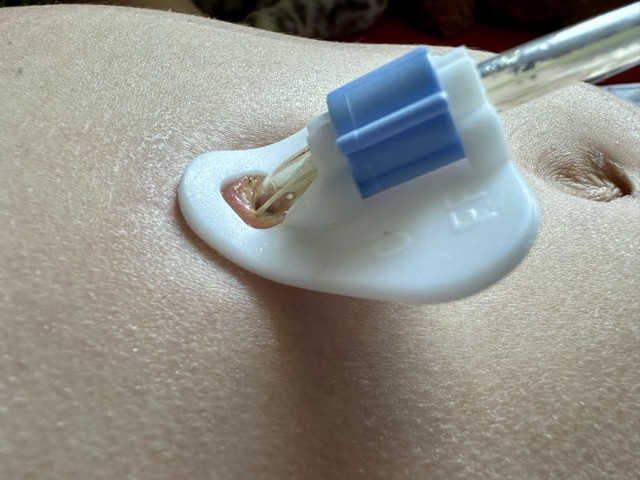 peg2.jpg